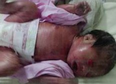 温州哪家医院做试管技术比较好？